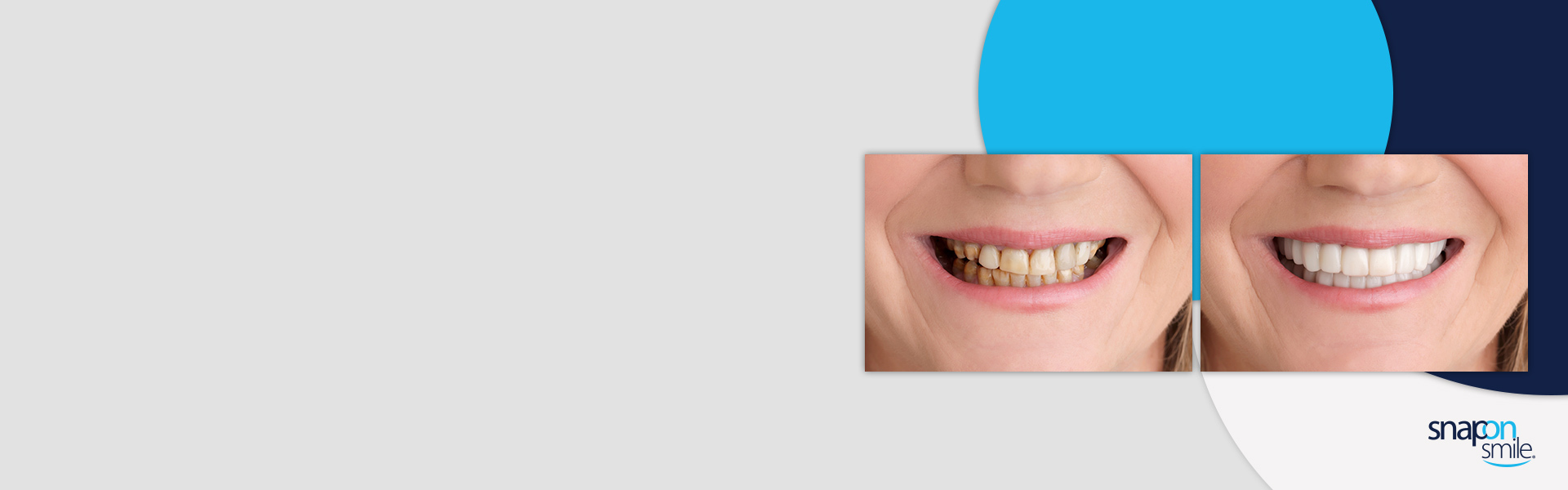 Dentist Cairns Future Dental