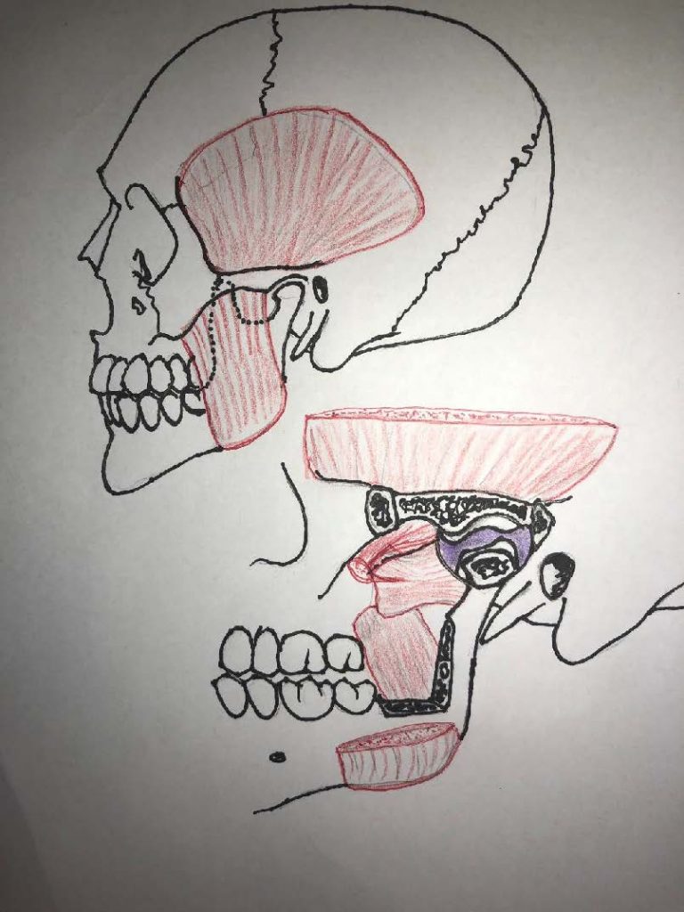 Occlusal Splint Therapy Cairns TMD Treatment Future Dental