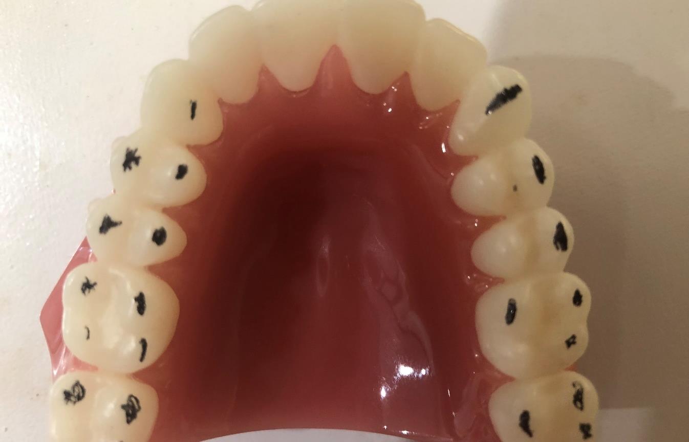 Occlusal Splint Therapy