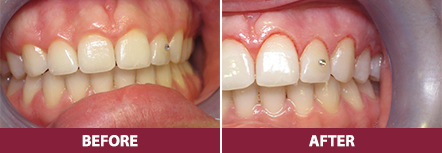 before-and-after-cleaning