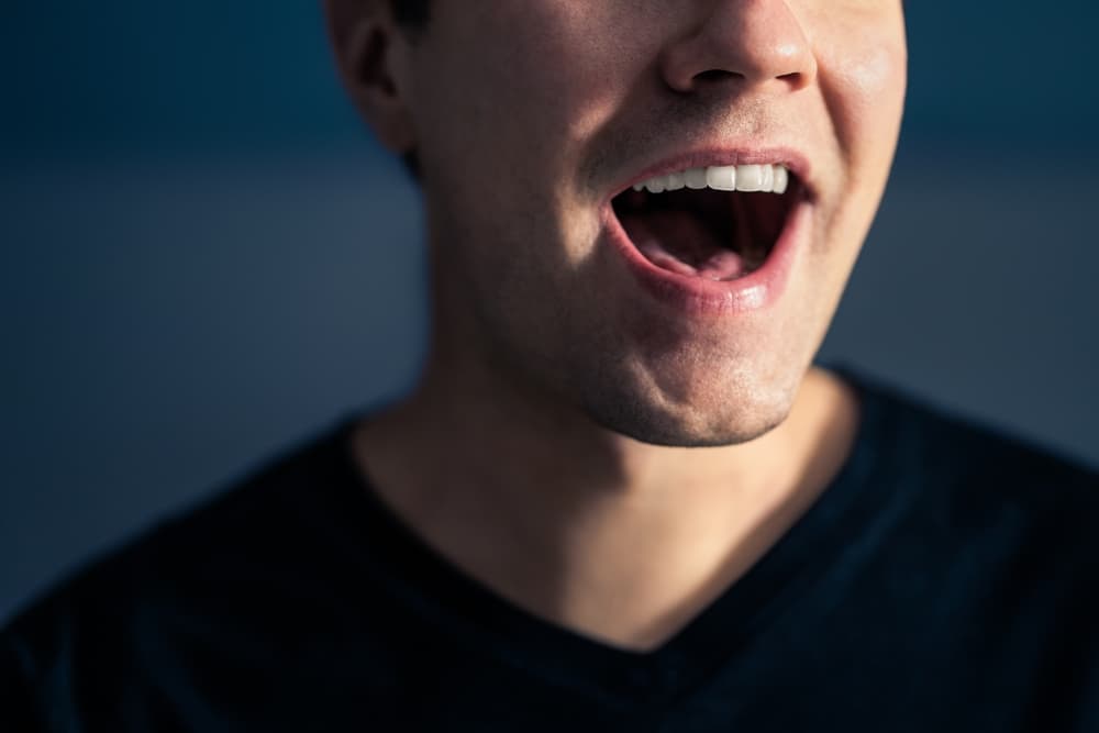frenectomy