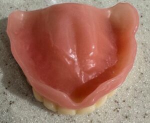 Thinking About new dentures?