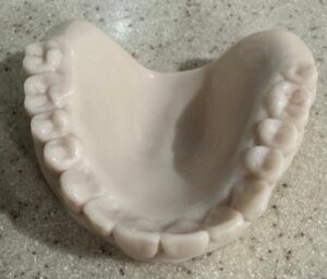 Thinking About new dentures?