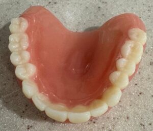 Thinking About new dentures?