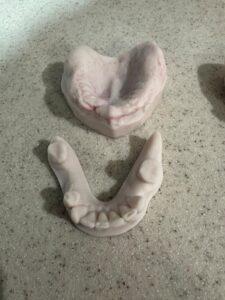 Thinking About new dentures?