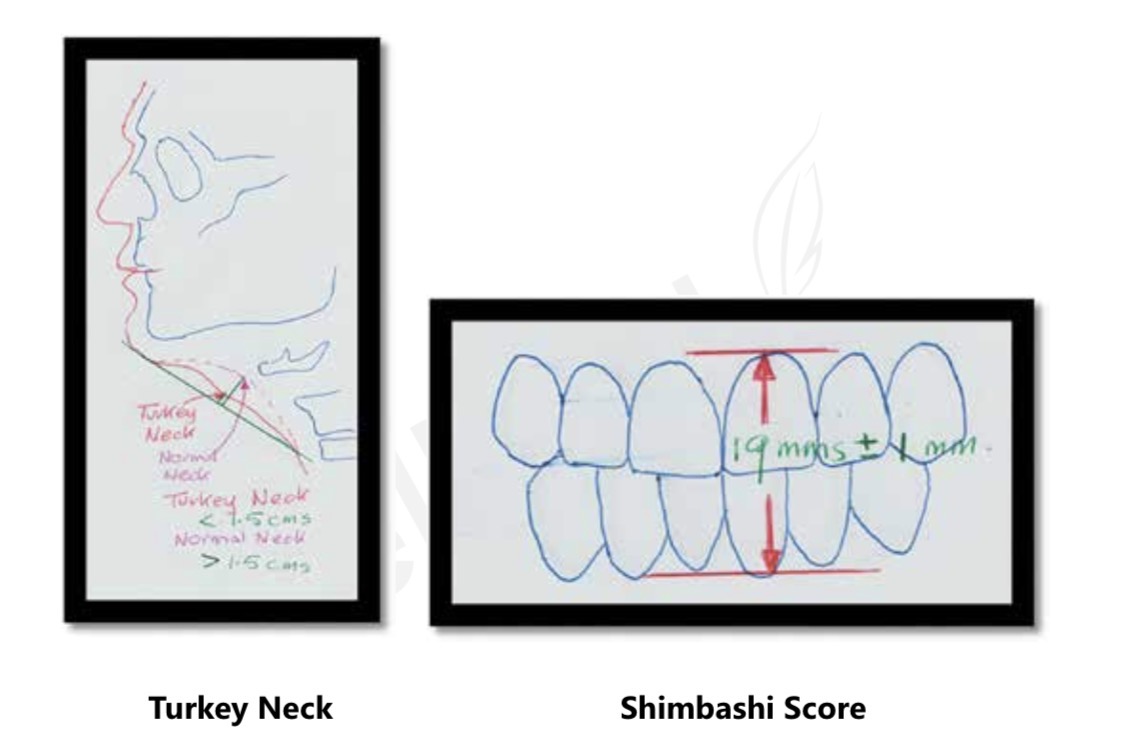 Turkey neck assessment and Shimbashi score diagram